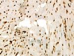 H3K122ac Antibody in Immunohistochemistry (Paraffin) (IHC (P))