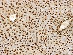 H3K122ac Antibody in Immunohistochemistry (Paraffin) (IHC (P))