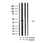 Acetyl-p53 (Lys373) Antibody in Western Blot (WB)