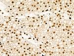 Acetyl-p53 (Lys373) Antibody in Immunohistochemistry (Paraffin) (IHC (P))