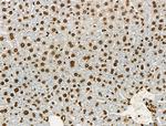 Acetyl-p53 (Lys373) Antibody in Immunohistochemistry (Paraffin) (IHC (P))