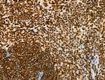 Acetyl-p53 (Lys373) Antibody in Immunohistochemistry (Paraffin) (IHC (P))