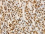 Acetyl-p53 (Lys373) Antibody in Immunohistochemistry (Paraffin) (IHC (P))