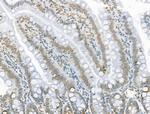 Acetyl-p53 (Lys373) Antibody in Immunohistochemistry (Paraffin) (IHC (P))