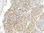 Acetyl-p53 (Lys373) Antibody in Immunohistochemistry (Paraffin) (IHC (P))