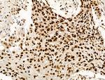 Acetyl-p53 (Lys373) Antibody in Immunohistochemistry (Paraffin) (IHC (P))