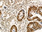 Acetyl-p53 (Lys373) Antibody in Immunohistochemistry (Paraffin) (IHC (P))