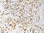 Acetyl-p53 (Lys373) Antibody in Immunohistochemistry (Paraffin) (IHC (P))