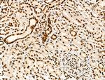 Acetyl-p53 (Lys373) Antibody in Immunohistochemistry (Paraffin) (IHC (P))