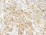 Acetyl-p53 (Lys381) Antibody in Immunohistochemistry (Paraffin) (IHC (P))