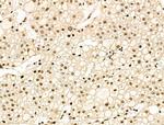 Acetyl-p53 (Lys381) Antibody in Immunohistochemistry (Paraffin) (IHC (P))