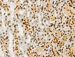 Acetyl-p53 (Lys381) Antibody in Immunohistochemistry (Paraffin) (IHC (P))