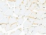 Acetyl-p53 (Lys381) Antibody in Immunohistochemistry (Paraffin) (IHC (P))