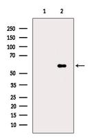 Phospho-PFKFB2 (Ser483) Antibody in Western Blot (WB)