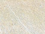 Phospho-ULK1 (Ser758) Antibody in Immunohistochemistry (Paraffin) (IHC (P))