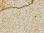 Phospho-ULK1 (Ser758) Antibody in Immunohistochemistry (Paraffin) (IHC (P))