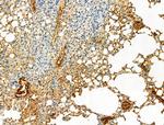 Phospho-ULK1 (Ser758) Antibody in Immunohistochemistry (Paraffin) (IHC (P))