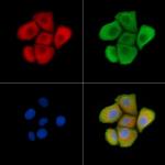 Phospho-TrkA/TrkB (Tyr785, Tyr816) Antibody in Immunocytochemistry (ICC/IF)