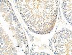 Phospho-CSF1R (Tyr708) Antibody in Immunohistochemistry (Paraffin) (IHC (P))