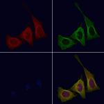 Phospho-CSF1R (Tyr708) Antibody in Immunocytochemistry (ICC/IF)