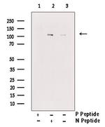 Phospho-CSF1R (Tyr708) Antibody in Western Blot (WB)