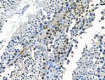 Phospho-CSF1R (Tyr723) Antibody in Immunohistochemistry (Paraffin) (IHC (P))