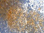 Phospho-PDGFRB (Tyr751) Antibody in Immunohistochemistry (Paraffin) (IHC (P))