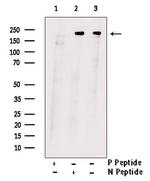 Phospho-PDGFRB (Tyr751) Antibody in Western Blot (WB)