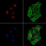 Phospho-ALOX5 (Ser272) Antibody in Immunocytochemistry (ICC/IF)