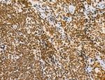 Phospho-Bcl-2 (Thr56) Antibody in Immunohistochemistry (Paraffin) (IHC (P))