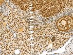 Phospho-Bcl-2 (Thr56) Antibody in Immunohistochemistry (Paraffin) (IHC (P))