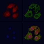 Phospho-Bcl-2 (Thr56) Antibody in Immunocytochemistry (ICC/IF)