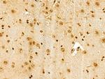 Phospho-SRC (Ser17) Antibody in Immunohistochemistry (Paraffin) (IHC (P))