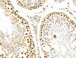 Phospho-SRC (Ser17) Antibody in Immunohistochemistry (Paraffin) (IHC (P))