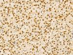 Phospho-SRC (Ser17) Antibody in Immunohistochemistry (Paraffin) (IHC (P))