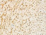 Phospho-Desmoplakin (Ser165, Ser166) Antibody in Immunohistochemistry (Paraffin) (IHC (P))