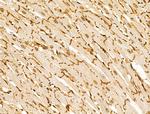 Phospho-Desmoplakin (Ser165, Ser166) Antibody in Immunohistochemistry (Paraffin) (IHC (P))