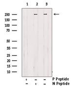 Phospho-Desmoplakin (Ser165, Ser166) Antibody in Western Blot (WB)