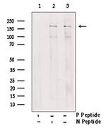 Phospho-IRS1 (Ser1101) Antibody in Western Blot (WB)