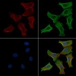 Phospho-MYH9 (Ser1943) Antibody in Immunocytochemistry (ICC/IF)