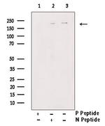 Phospho-TSC2 (Tyr1571) Antibody in Western Blot (WB)