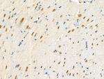 Phospho-TOB1 (Ser164) Antibody in Immunohistochemistry (Paraffin) (IHC (P))