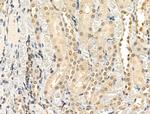 Phospho-TOB1 (Ser164) Antibody in Immunohistochemistry (Paraffin) (IHC (P))