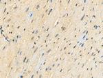 Phospho-CDK9 (Thr186) Antibody in Immunohistochemistry (Paraffin) (IHC (P))