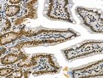 Phospho-IRAK1 (Thr100) Antibody in Immunohistochemistry (Paraffin) (IHC (P))