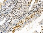 Phospho-IRAK1 (Thr100) Antibody in Immunohistochemistry (Paraffin) (IHC (P))