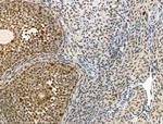 Phospho-IRAK1 (Thr100) Antibody in Immunohistochemistry (Paraffin) (IHC (P))