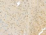 Phospho-IRAK1 (Thr209) Antibody in Immunohistochemistry (Paraffin) (IHC (P))