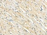 Phospho-IRAK1 (Thr209) Antibody in Immunohistochemistry (Paraffin) (IHC (P))