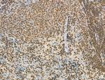 Phospho-IRAK1 (Thr209) Antibody in Immunohistochemistry (Paraffin) (IHC (P))